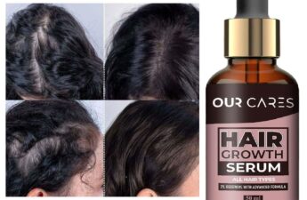 best hair serum for hair fall control men